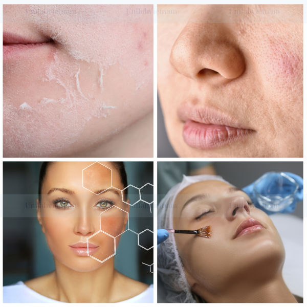 Hydrolyzed Sponge