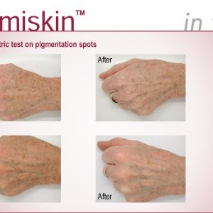 LUMISKIN™ – HOẠT CHẤT ỨC CHẾ MELANIN LÀM SÁNG DA