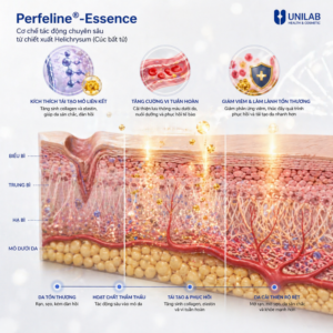 Perfeline®-Essence Ngừa Rạn Da Mờ Sẹo