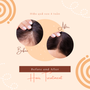 CocoaRevive – Hoạt Chất Hỗ Trợ Mọc Tóc