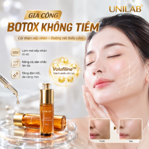 Gia công botox không tiêm